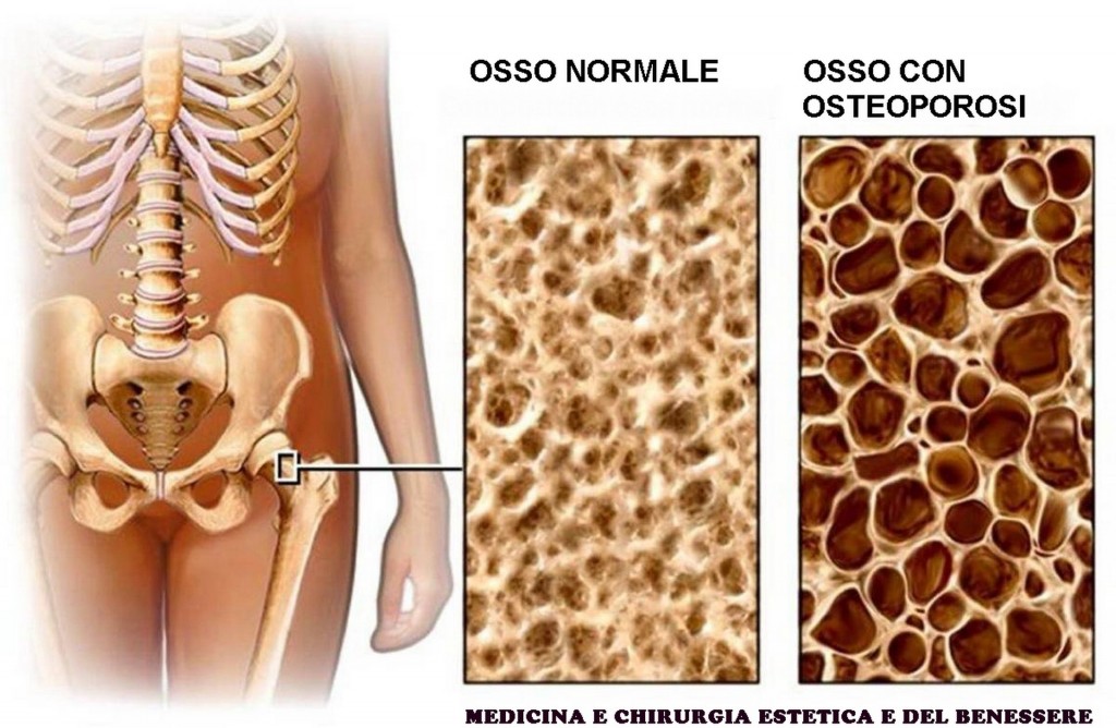 DENSITOMETRIA OSSEA Farmacia Sarmeola